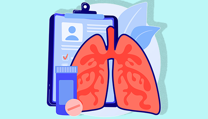 ¿Cómo aliviar los síntomas de la bronquitis?